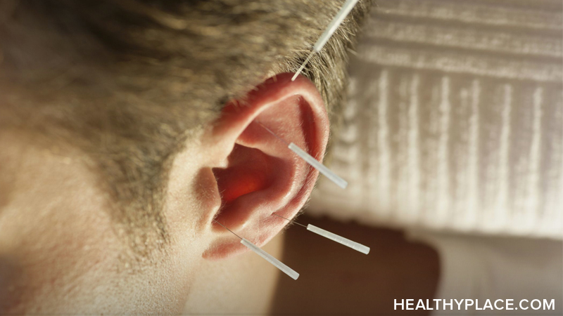 抑郁疗法概述,治疗抑郁症,包括草药,营养治疗,针灸,心理疗法,轻疗,自助。