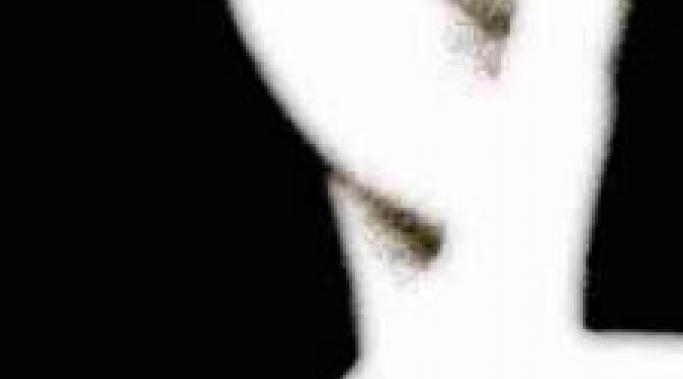 什么时候我应该告诉别人我有精神疾病?