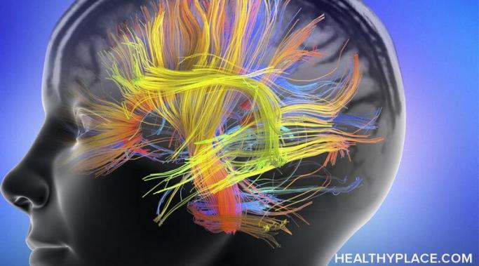 Get Your Brain Motivated to Recover From PTSD 你创伤后应激障碍的大脑需要帮助来激励自己愈合。创伤后应激障碍会让你的大脑在创伤中发呆。你可以教你的大脑自愈。这是如何。