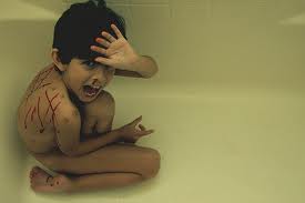 儿童身体虐待撕裂痕