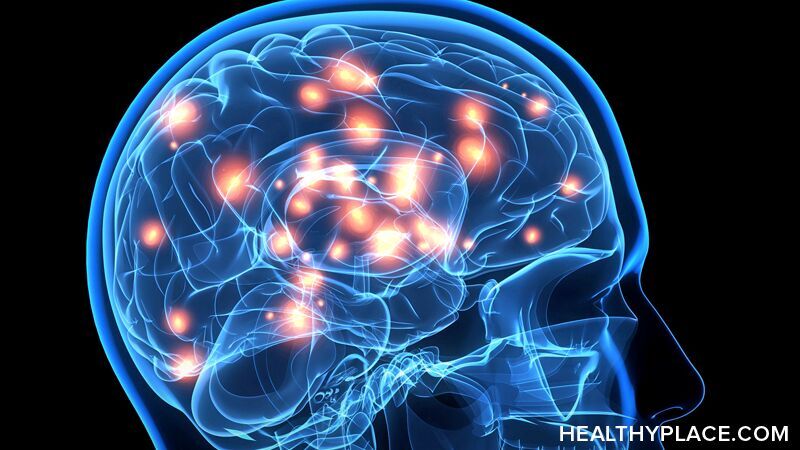 双相情感障碍的病因包括生化、遗传和环境因素。在HealthyPlace阅读更多关于双相情感障碍的原因。