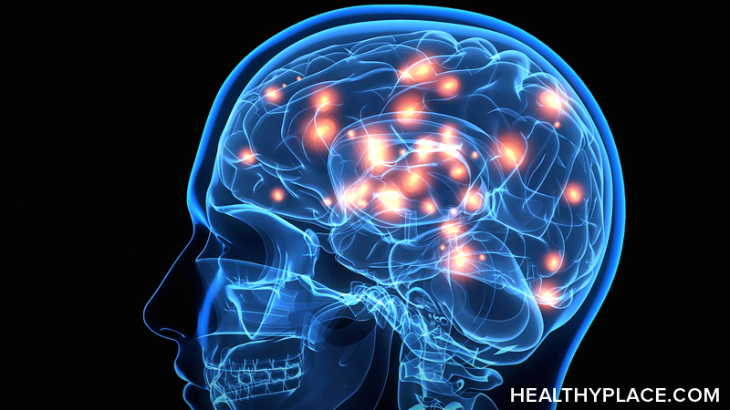 帕金森的疾病大脑如何不同？了解帕金森的影响如何影响大脑，在健康的地方扫描脑扫描。